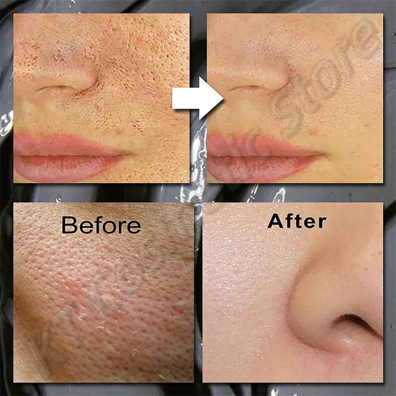 Volcanic Mud Mask Face Deep Cleaning Pores Remove Blackheads Oil Control Moisturizing Brighten Smooth Skin Care Beauty Products